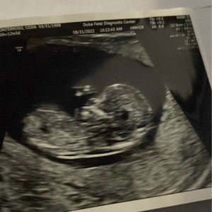 Meet your Posher, Cesia